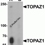 Western blot analysis of TOPAZ1 in human testis tissue lysate with TOPAZ1 antibody at 1 μg/ml in (A) the absence and (B) the presence of blocking peptide.