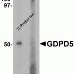Western blot analysis of GDPD5 in mouse kidney tissue lysate with GDPD5 antibody at 1 μg/ml in (A) the absence and (B) the presence of blocking peptide.