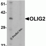 Western blot analysis of OLIG2 in EL4 cell lysate with OLIG2 antibody at 1 μg/ml in (A) the absence and (B) the presence of blocking peptide.