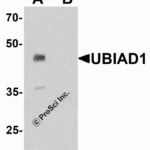 Western blot analysis of UBIAD1 in mouse liver tissue lysate with UBIAD1 antibody at 1 μg/ml in (A) the absence and (B) the presence of blocking peptide.