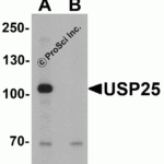Western blot analysis of USP25 in mouse brain tissue lysate with USP25 antibody at 1 μg/ml in (A) the absence and (B) the presence of blocking peptide.