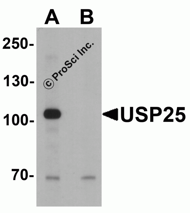 USP25 Peptide