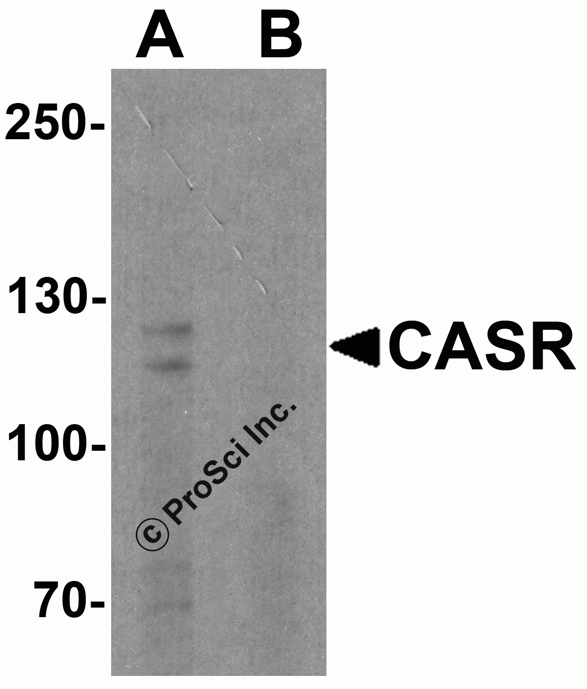 CASR Peptide