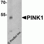 Western blot analysis of PINK1 in A431 cell lysate with PINK1 antibody at 1 μg/ml in (A) the absence and (B) the presence of blocking peptide.