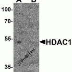 Western blot analysis of HDAC1 in human brain tissue lysate with HDAC1 antibody at 1μg/ml in (A) the absence and (B) the presence of blocking peptide.
