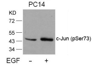 c Jun (phospho Ser73) Antibody