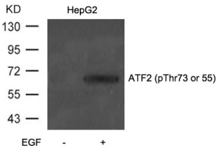 ATF2 (phospho Thr73 / 55) Antibody