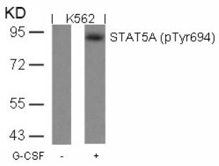 STAT5A (phospho Tyr694) Antibody