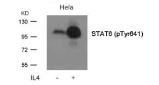 STAT6 (phospho Tyr641) Antibody