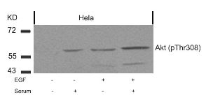 Akt (phospho Thr308) Antibody