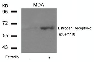 Estrogen Receptor a (phospho Ser118) Antibody