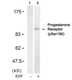 Progesterone Receptor (phospho Ser190) Antibody