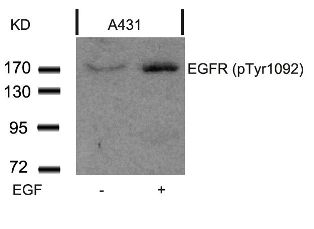 EGFR (phospho Tyr1092) Antibody