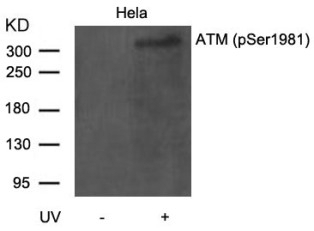 ATM (phospho Ser1981) Antibody