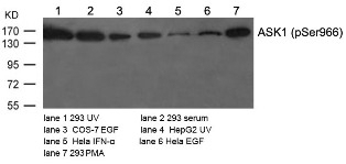 ASK1 (phospho Ser966) Antibody