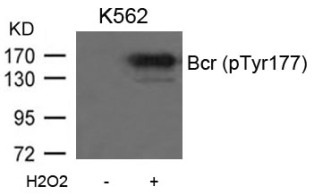 Bcr (phospho Tyr177) Antibody