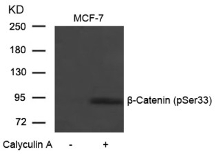 beta Catenin (phospho Ser33) Antibody