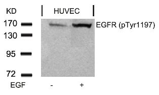 EGFR (phospho Tyr1197) Antibody