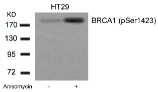 BRCA1 (phospho Ser1423) Antibody