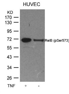 RelB (phospho Ser573) Antibody