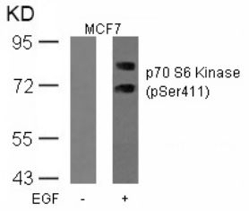 p70 S6 Kinase (phospho Ser411) Antibody
