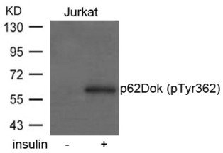 p62Dok (phospho Tyr362) Antibody
