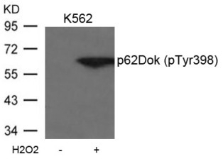 p62Dok (phospho Tyr398) Antibody