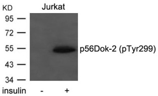 p56Dok 2 (phospho Tyr299) Antibody