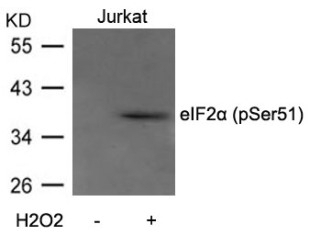 eIF2a (phospho Ser51) Antibody
