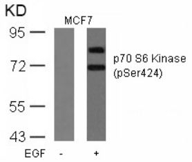 p70 S6 Kinase (phospho Ser424) Antibody