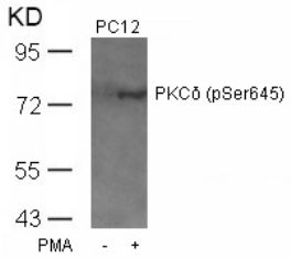 PKCdelta (phospho Ser645) Antibody
