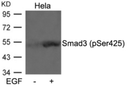 Smad3 (phospho Ser425) Antibody