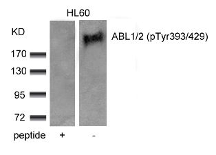 ABL1 / 2 (phospho Tyr393 / Tyr429) Antibody