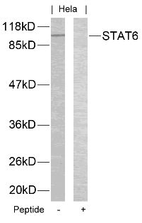 STAT6 (Ab 645) Antibody