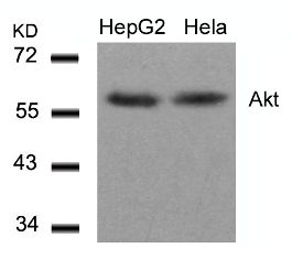 Akt (Ab 308) Antibody