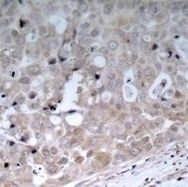 VEGFR2 (Ab 1175) Antibody