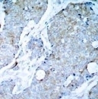 VEGFR2 (Ab 1214) Antibody