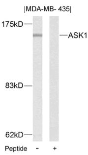ASK1 (Ab 83) Antibody