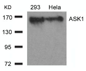 ASK1 (Ab 966) Antibody