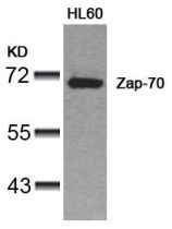 Zap 70 (Ab 319) Antibody