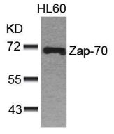 Zap 70 (Ab 493) Antibody