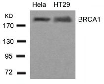 BRCA1 (Ab 1423) Antibody