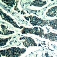 AKT1 / AKT2 / AKT3 (Ab 315 / 316 / 312) Antibody