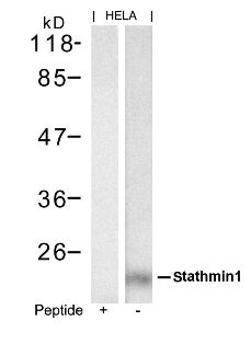 stathmin1 (Ab 62) Antibody