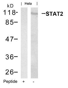 STAT2 (Ab 690) Antibody