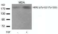 HER2 (phospho Tyr1221 / Tyr1222) Antibody