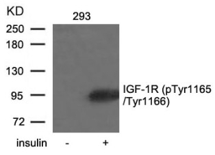 IGF 1R (phospho Tyr1165 / Tyr1166) Antibody