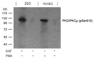 PKD / PKCmu (phospho Ser910) Antibody
