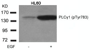 PLCgamma1 (phospho Tyr783) Antibody