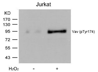 Vav (phospho Tyr174) Antibody
